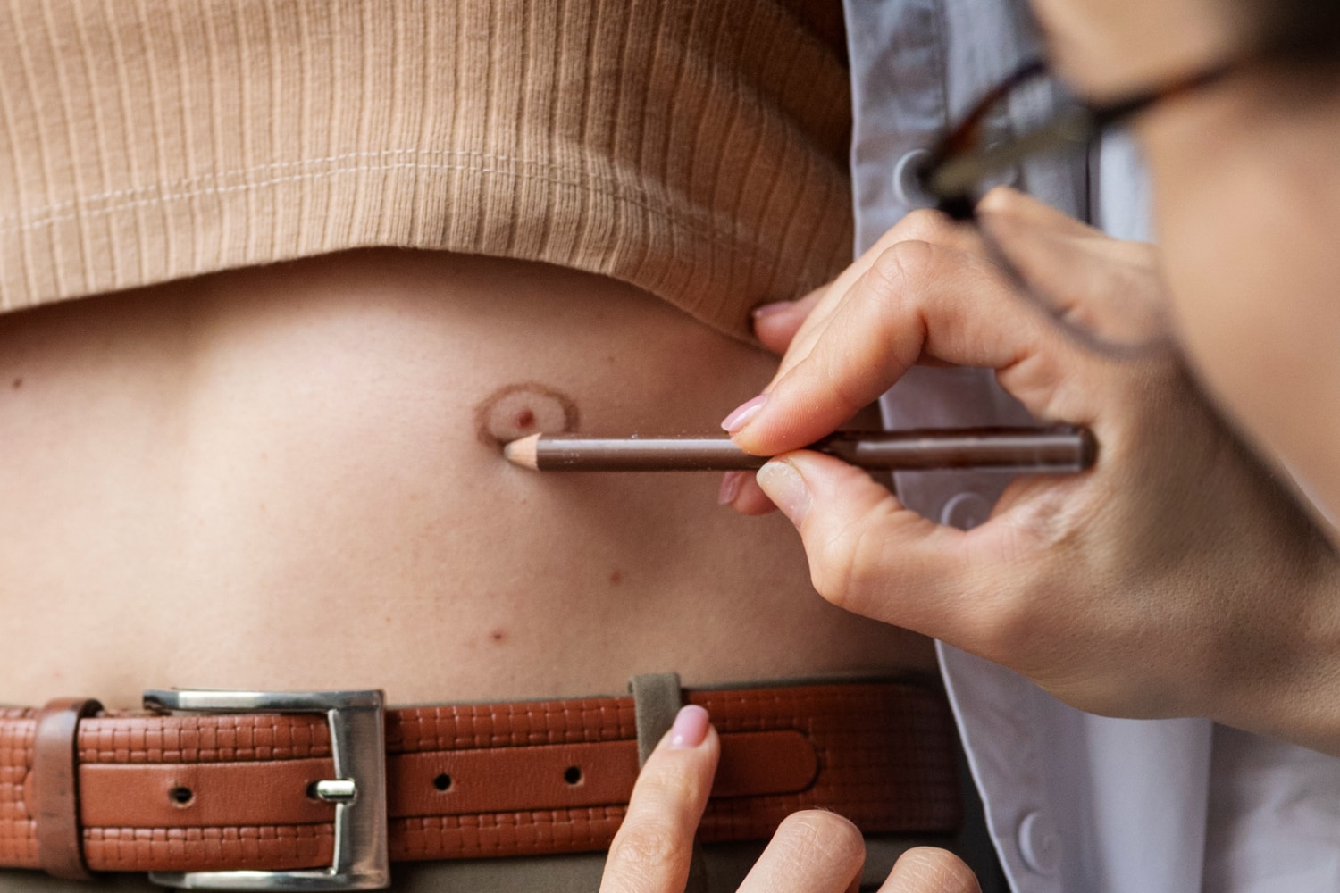 Dispositivos y accesorios de ostomía para mejorar la calidad de vida del paciente